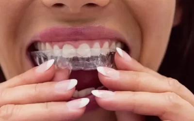 Invisalign Madison: Clear Aligner Therapy for Discreet Orthodontic Correction